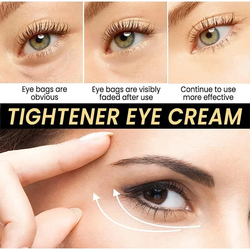 Cëlyn 3 Minutes Instant Firm Eye Cream Wrinkle Removal Lifting Tighten Remove Eye Bags Dark Circles Moisturize Peptide Eye Cream