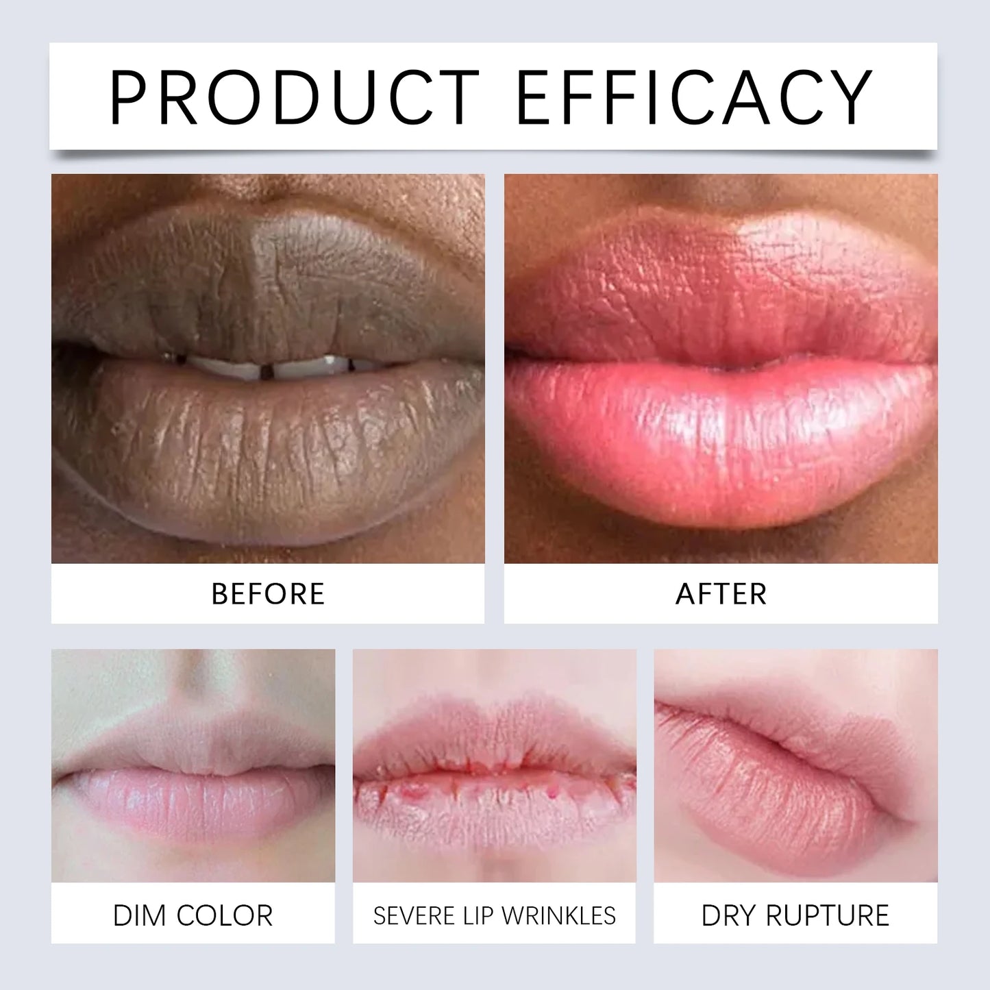 OUHOE Lip Balm - Long - term Hydration, Anti - dryness, Lighten Lip Color, Easy to Apply, Exfoliate Gently